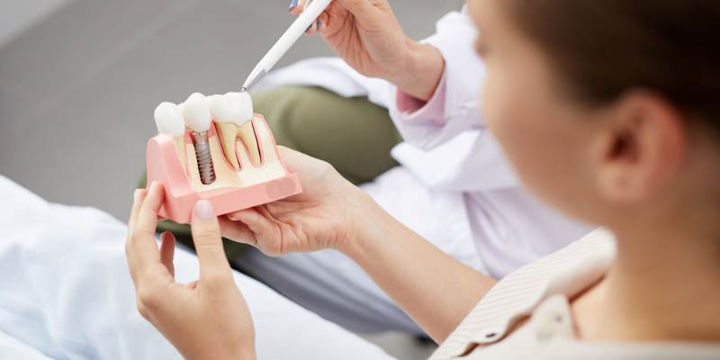 Tooth Implant Clinic Davanagere explaining dental implant treatment