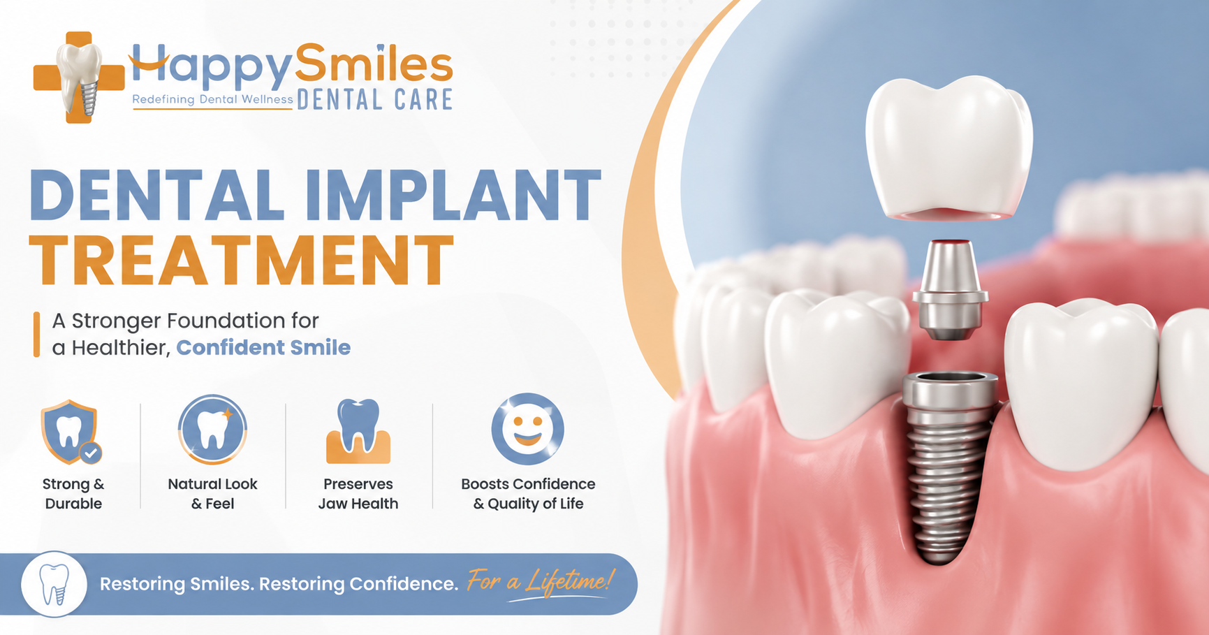 Dental implants Vidyanagar