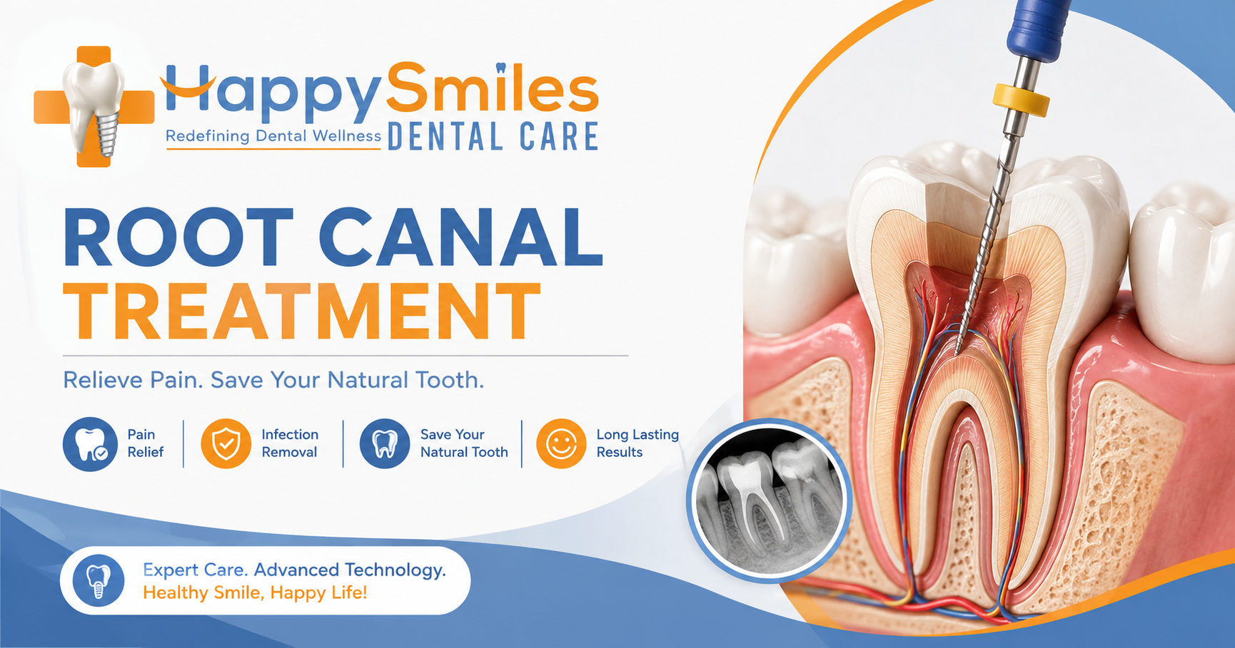 Root Canal Treatment Near Vidyanagar Main Road Davangere