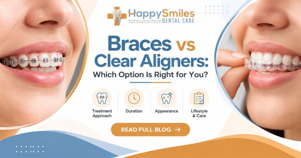 Braces vs Clear Aligners