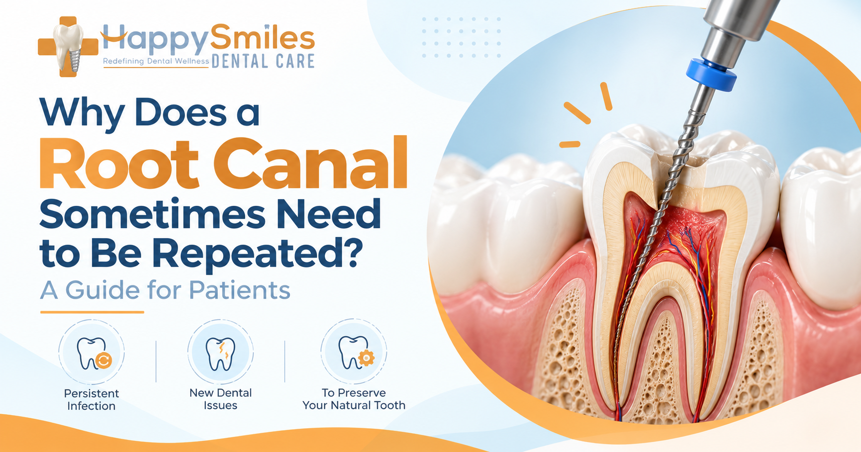root-canal-treatment-in-Davangere